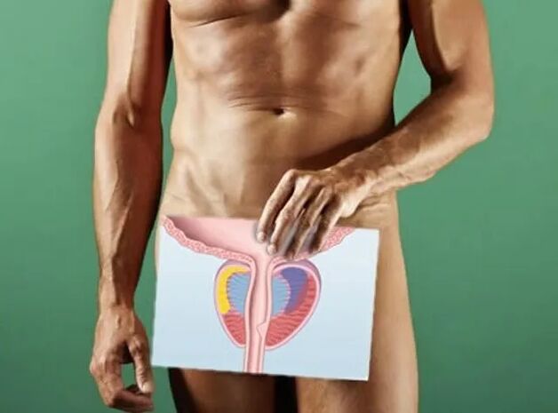 Prostatitis in men