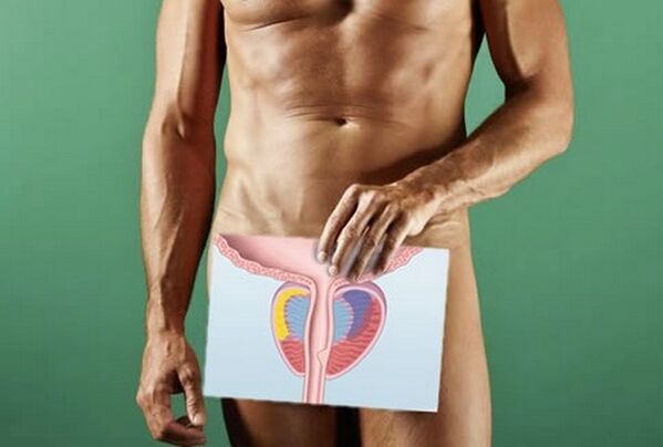 A man with prostatitis
